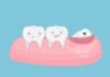 Is it Possible to Extract Multiple Teeth? wisdom tooth extraction cost