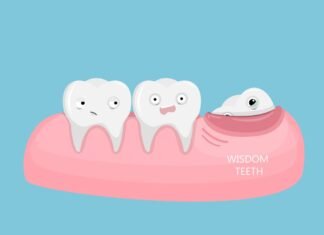 Is it Possible to Extract Multiple Teeth? wisdom tooth extraction cost
