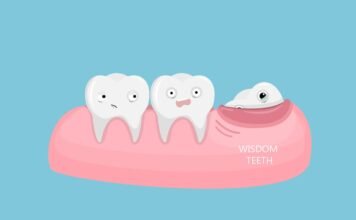 Is it Possible to Extract Multiple Teeth? wisdom tooth extraction cost
