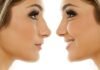 Will You Age Naturally If You Have Cosmetic Surgery? plastic surgery cost
