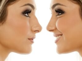 Will You Age Naturally If You Have Cosmetic Surgery? plastic surgery cost