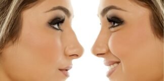 Will You Age Naturally If You Have Cosmetic Surgery? plastic surgery cost