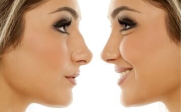 Will You Age Naturally If You Have Cosmetic Surgery? plastic surgery cost