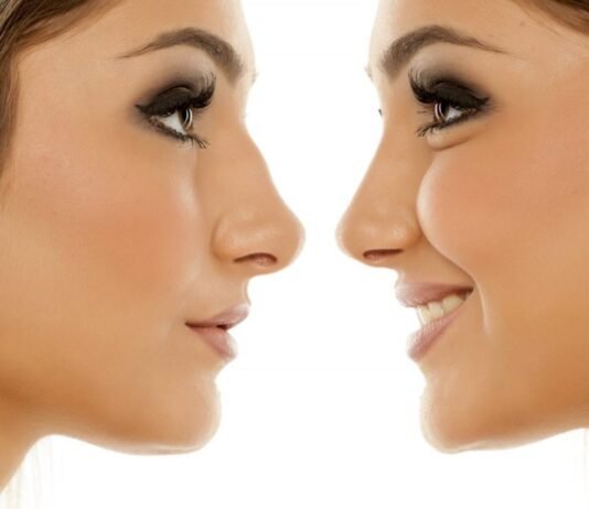 Will You Age Naturally If You Have Cosmetic Surgery? plastic surgery cost